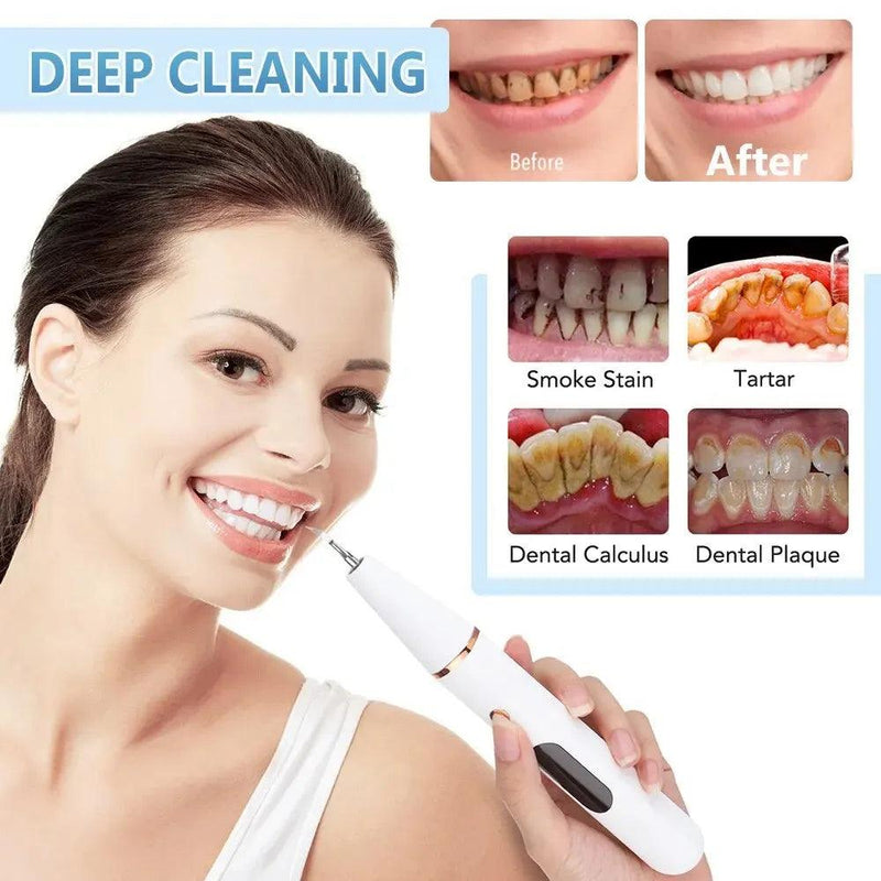 Removedor dental tártaro limpador dente